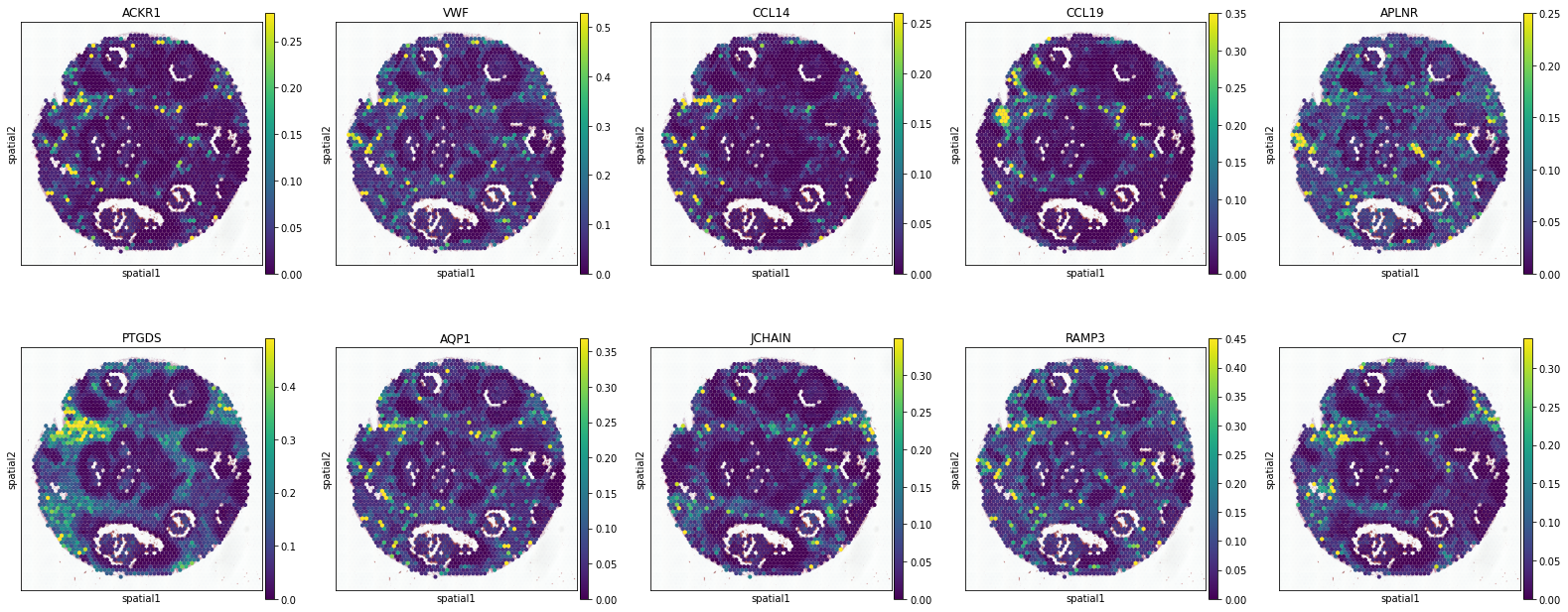 _images/BRCA-A_11_11.png