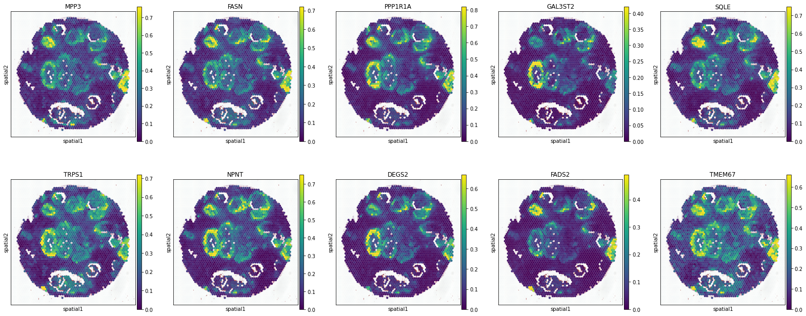 _images/BRCA-A_11_5.png