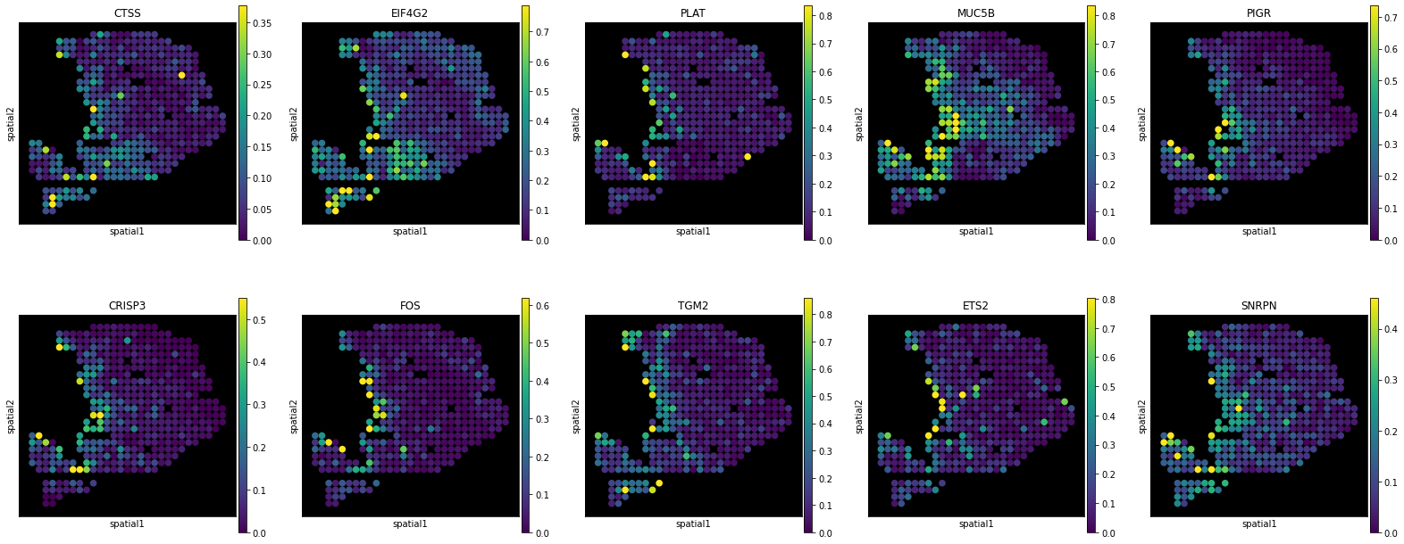 _images/PDAC-A_11_1.png
